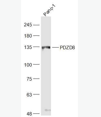 Anti-PDZD8 antibody-PDZ结构域PDZK8蛋白抗体,PDZD8