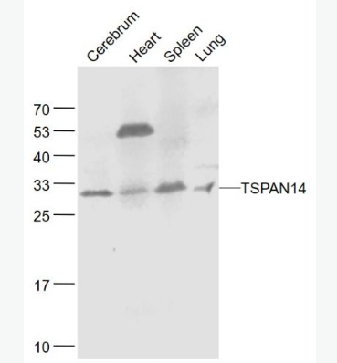 Anti-TSPAN14  antibody-四分子交聯(lián)體14抗體（四旋蛋白）,TSPAN14