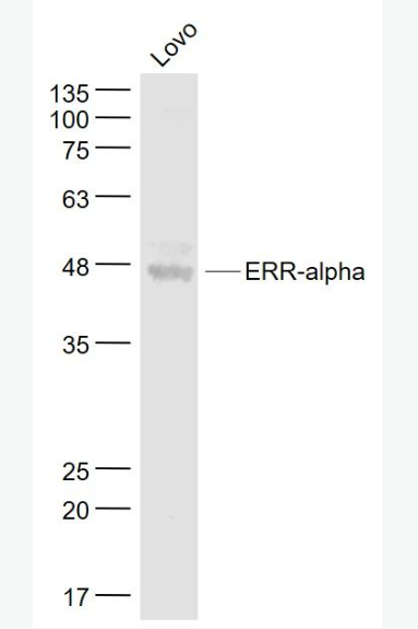 nti-ERR-alpha antibody-雌激素受體相關蛋白α抗體,ERR-alpha