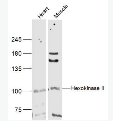 Anti-Hexokinase II antibody-己糖激酶2抗體,Hexokinase II