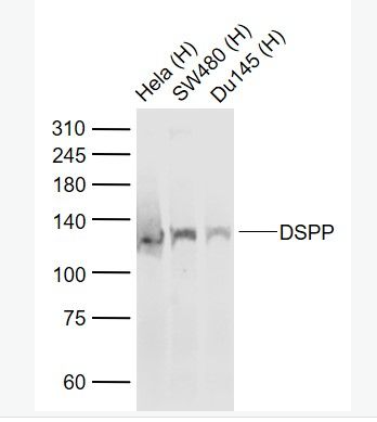 Anti-DSPP antibody-牙本质磷蛋白抗体,DSPP