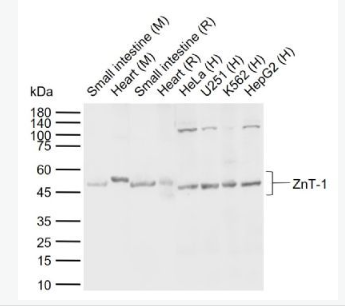 Anti-ZnT-1  antibody-锌转运蛋白1抗体,ZnT-1