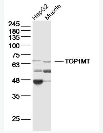 Anti-TOP1MTantibody-线粒体DNA拓普西异构酶Ⅰ抗体,TOP1MT