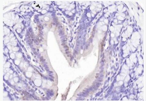 Anti-FAF1 antibody-Fas相关1因子抗体,FAF1