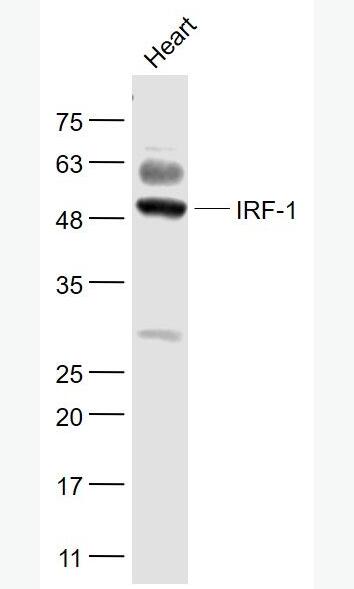 Anti-IRF1 antibody-干擾素調(diào)節(jié)因子1抗體,IRF1