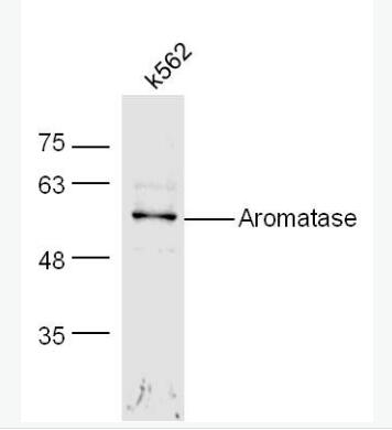 Anti-Aromatase antibody-芳香化酶/细胞色素P450/雌激素合成酶抗体,Aromatase