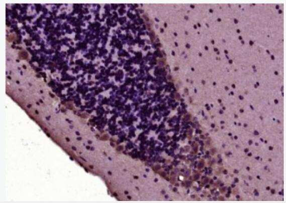 Anti-phospho-Tau (Thr498) antibody-磷酸化微管相關(guān)蛋白抗體,phospho-Tau (Thr498)