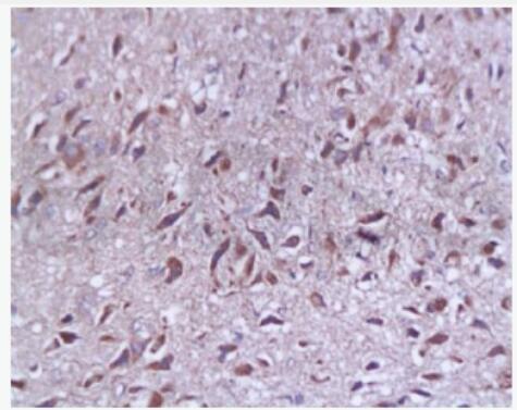 Anti-SYAP1  antibody-突觸相關(guān)蛋白-1抗體,SYAP1