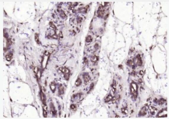 Anti-Resistin  antibody-抵抗素抗體,Resistin