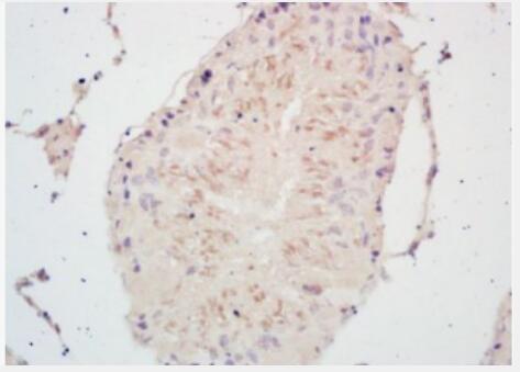 Anti-PSCA antibody-前列腺干细胞抗原抗体,PSCA