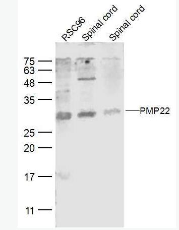 Anti-MMP1 antibody-外基质金属蛋白酶-1抗体,MMP1