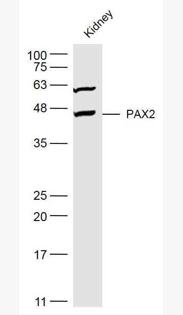 Anti-PAX2 antibody-配对盒基因2抗体,PAX2