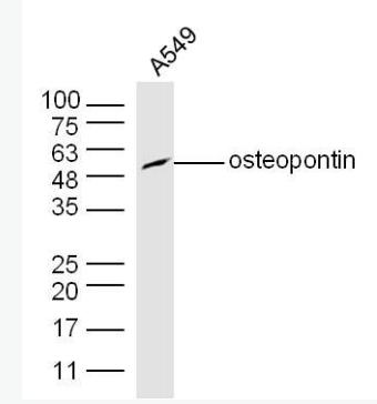 Anti-Osteopontin antibody-骨桥蛋白/分泌型磷蛋白1抗体,Osteopontin