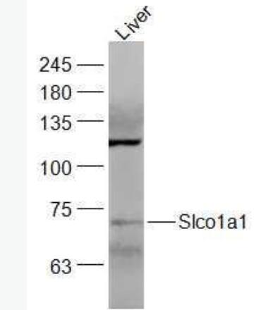 Anti-Slco1a1 antibody-外溶质载体有机阴离子转运蛋白家族成员1A1抗体,Slco1a1