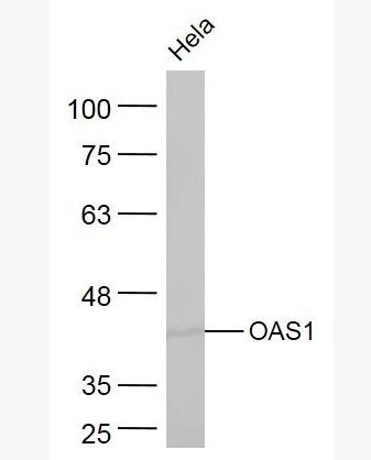 Anti-OAS1   antibody-寡腺苷酸合成酶-1抗體,OAS1