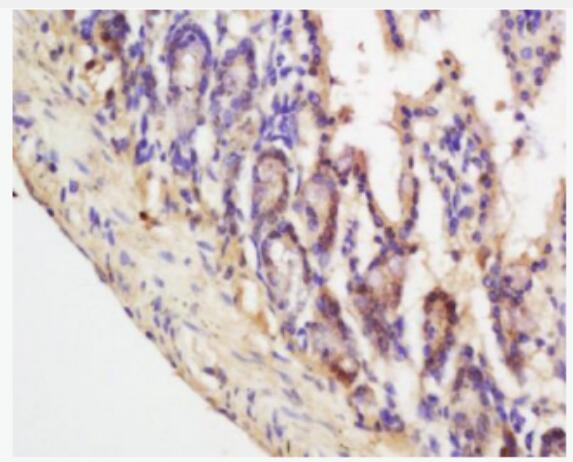 Anti-ASPP1 antibody-p53凋亡刺激蛋白1抗體,ASPP1