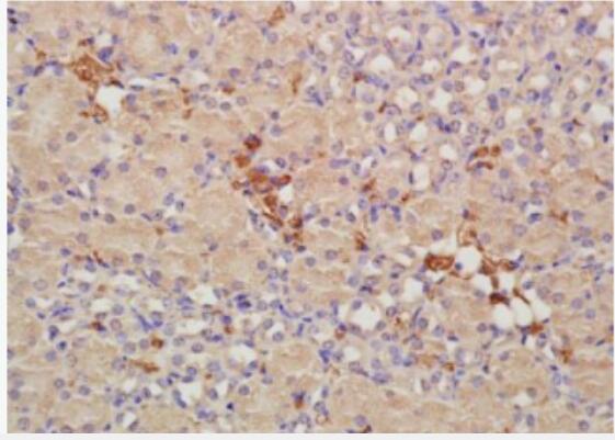 Anti-CRIM1 antibody-富含半胱氨酸运动神经元蛋白1抗体,CRIM1