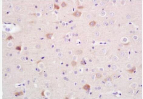 Anti-Alpha-Synuclein antibody-核突觸蛋白抗體,Alpha-Synuclein