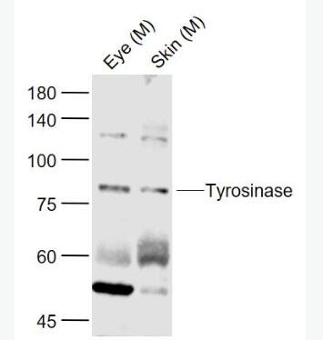 Anti-Tyrosinase  antibody-酪氨酸酶抗體,Tyrosinase