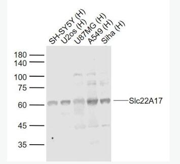 Anti-Slc22A17 antibody-可溶性载质转运蛋白22A17抗体,Slc22A17