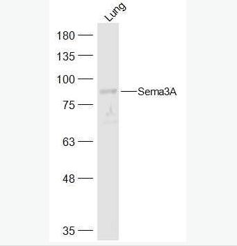 Anti-Sema3A  antibody-臂板蛋白3A抗体,Sema3A
