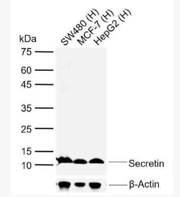 Anti-Secretin antibody-分泌素抗体,Secretin