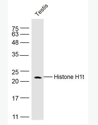 Anti-Histone H1t antibody-组蛋白H1抗体,Histone H1t