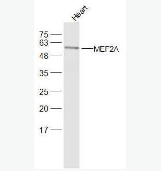 Anti-DMEF2A  antibody-肌細胞增強因子2抗體,MEF2A