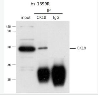 Anti-E2F4 antibody-转录因子E2F-4抗体,E2F4