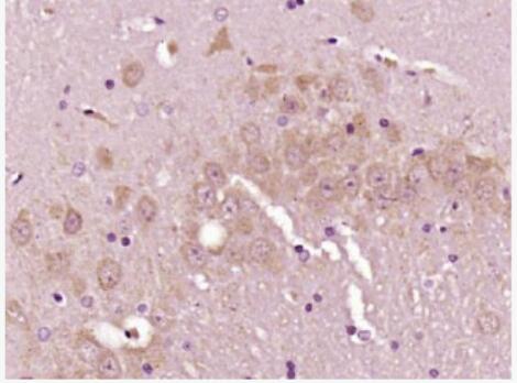 Anti-factor V antibody-凝血因子5抗体,factor V