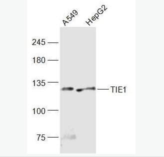 Anti-TIE1  antibody-血管生成素受体1抗体,TIE1