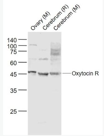 Anti-Oxytocin R  antibody-催产素受体(缩宫素受体)抗体,Oxytocin R