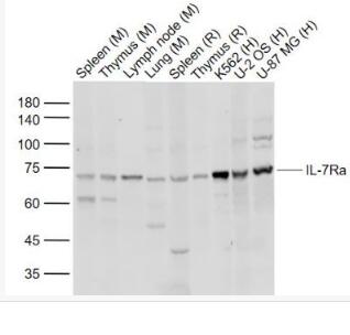 Anti-IL7R antibody-白细胞介素-7受体a（CD127）抗体,IL7R