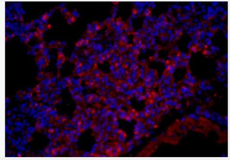 Anti-Fx1A  antibody-腎刷狀緣抗體,Fx1A