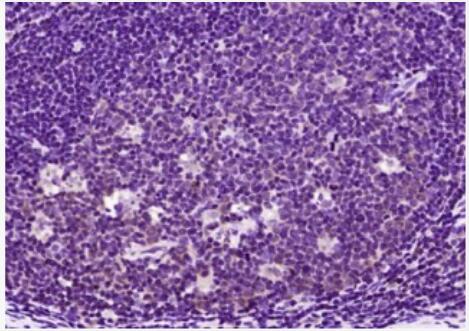 Anti-IFI16 antibody-γ干扰素诱导蛋白16抗体,IFI16