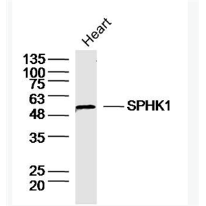 Anti-SPHK1  antibody-鞘氨醇激酶1抗体,SPHK1