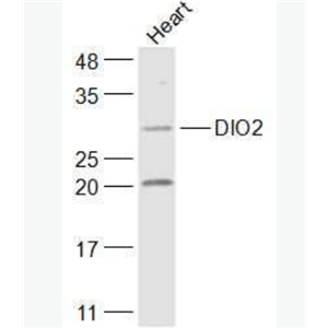 Anti-DIO2 antibody-脱碘酶2抗体,DIO2