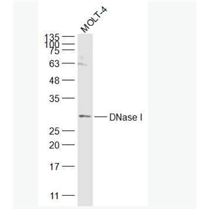 Anti-DNase I antibody-脱氧核糖核酸酶1抗体