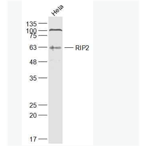 Anti-RIP2  antibody-受体结合丝氨酸苏氨酸激酶2抗体,RIP2