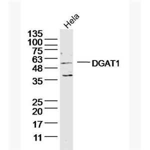 Anti-DGAT1 antibody-二脂酰甘油酰基转移酶抗体