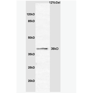 Anti-CCNG2 antibody-周期素G2抗体