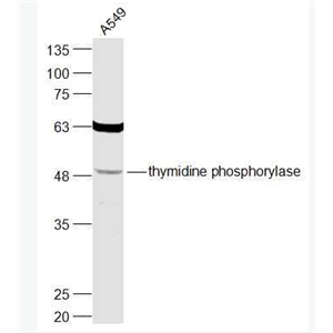 Anti-thymidine phosphorylase  antibody-胸苷磷酸化酶抗体
