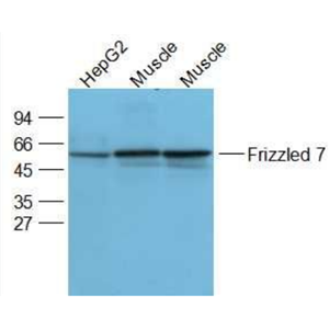 Anti-Frizzled   antibody-卷曲蛋白FZD7抗体