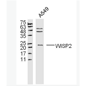 Anti-WISP2  antibody-Wnt1诱导信号通路蛋白2抗体