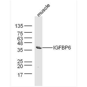 Anti-IGFBP6  antibody-胰岛素样生长因子结合蛋白6抗体
