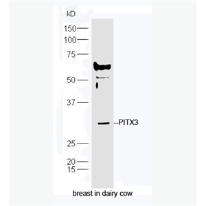 Anti-PITX3  antibody-PITX3抗体