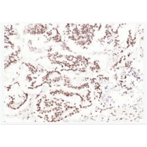 Anti-CDCA7 antibody-细胞分裂周期相关蛋白