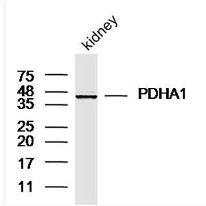 Anti-PDHA1 antibody-丙酮酸脱氢酶α1抗体