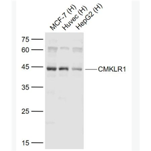 Anti-CMKLR1 antibody-趋化样因子受体1抗体