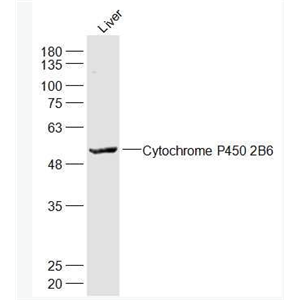 Anti-Cytochrome P450 2B6  antibody-细胞色素P450 2B6抗体